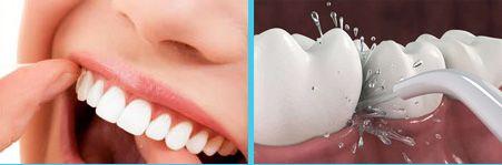 toothbrush and dental water jet (3) sonic toothbrush and dental water jet Conclusion: Water