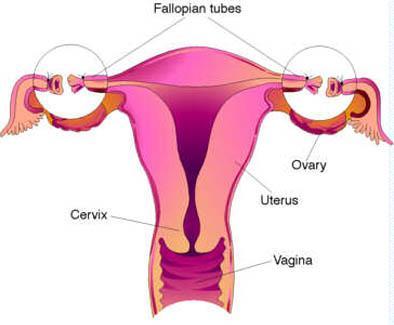 Tubal Ligation Permanent contraception Surgical procedure (cuts the fallopian tube) Same day