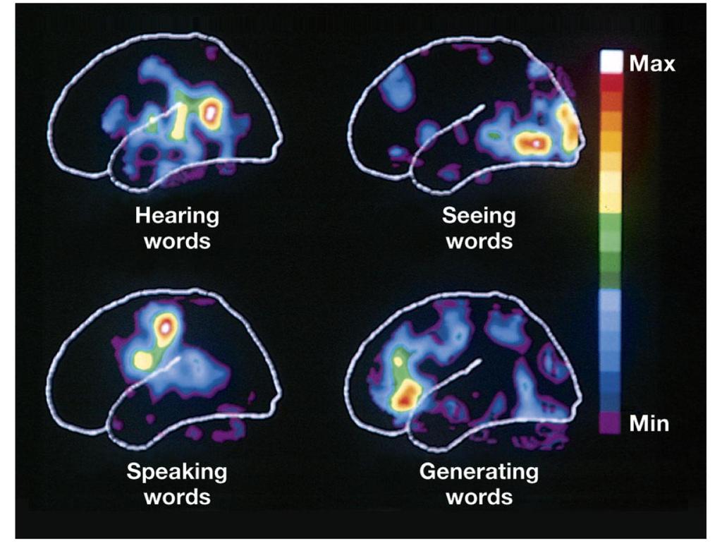 Speaking a Heard Word PET Scans of Functional Brain Areas Motor cortex Broca s area Figure 9-17 Hear words Auditory cortex Wernicke s area Brain