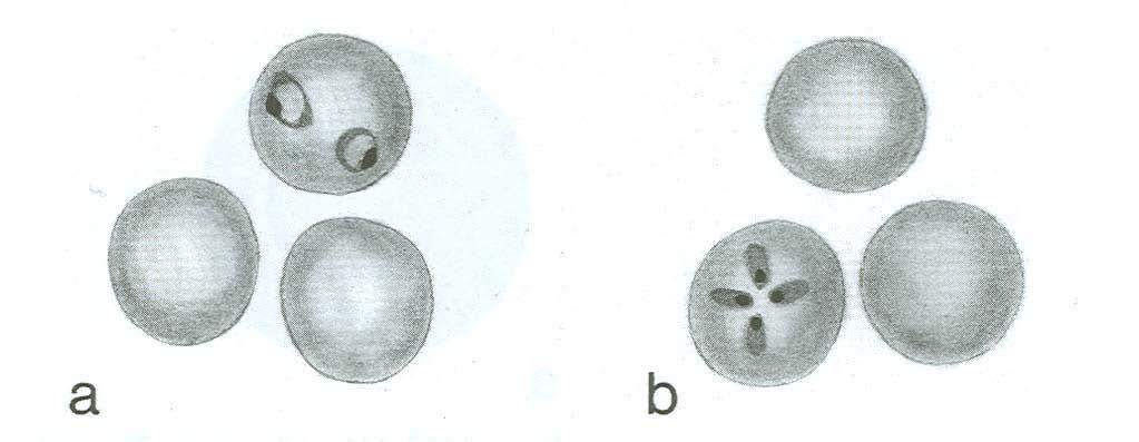 Pencil Sketch A. Plasmodium falciparum rings: multiple rings per cell are typical of P.