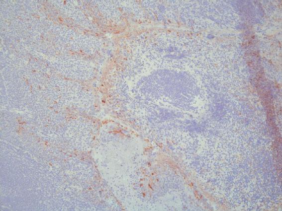 (C) Overview section of human tonsil (control tissue) confirms MIP-1β protein expression as predicted. Original magnification x100.