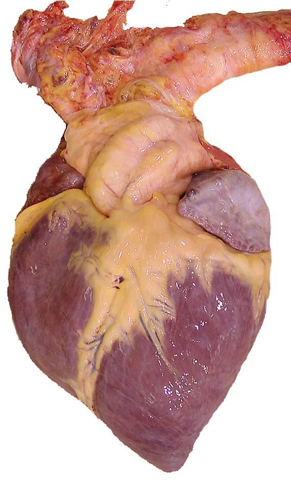 Compensatory Mechanisms of the Heart Through effective compensatory mechanisms, the heart can meet increased cardiac demand up to a point.