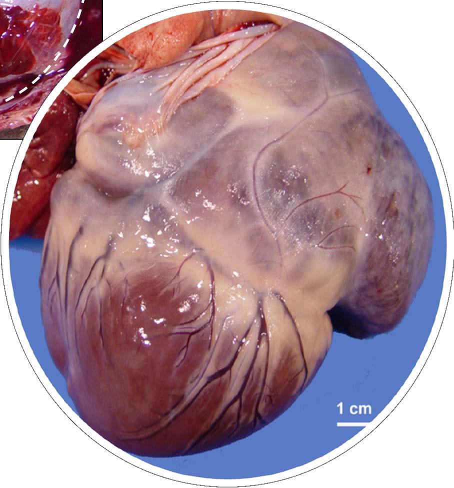 wide on the base 20 ml of fluid in the pericardial sac RV concentric