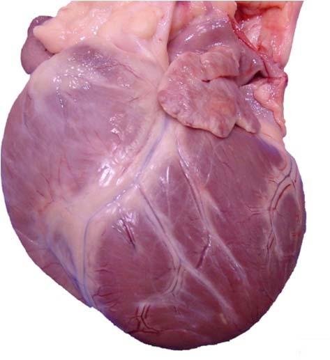 Cardiac Hypertrophy and Dilation Cardiac hypertrophy, an adaptive heart response, occurs when increased cardiac workload is sustained over several days or weeks.