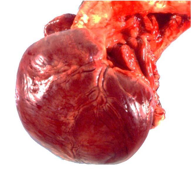 Gross Changes in Cardiac Hypertrophy