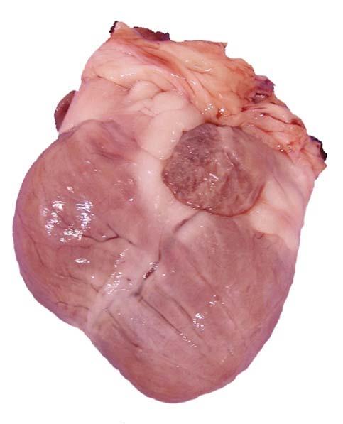 Bi-ventricular Globose (rounded)