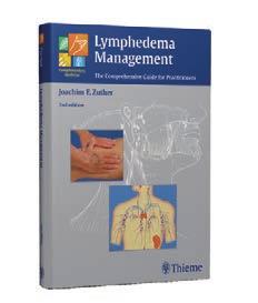 Best Practice for the Management of Lymphoedema. International consensus. London: MEP Ltd, 2006 3. Mansel, E., Fallowfiled. L., Kissin, M. Goyal, A., Newcombe, RG., Dixon, J., Yiang, C. Horgan, K.