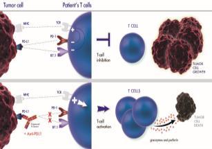aberrant PD-L1 expression Yu et al, CCR, 2013 Inhibiting the PD-L1/PD-1 interaction can restore antitumor immunity Spigel D et al. ASCO 2013. Abstract 8008.