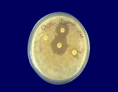 Whereas case of S aureus and klebesilla was around 21 and 19 at highest level of 100µL. E.coli has showed highly sensitivity of high S.