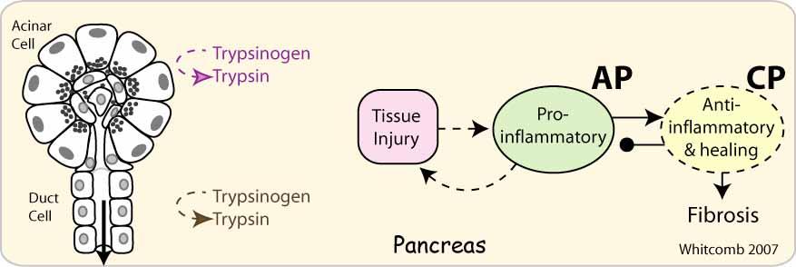Interaction of Trypsin, CFTR and SPINK1 Trypsinogen (PRSS1) R122H, N29I etc = Injury CFTR Severe