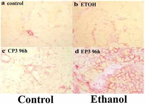 Fibrosis in RAP and ETOH The relative mrna expression levels of collagen α1 in control and alcohol-treated rats after 1 and 3episodes of pancreatitis *: p < 0.05, **: P<0.01.
