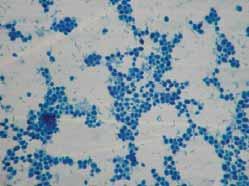 Frequency of identified microbes by microscopic examination using four different staining methods: - cocci 92 %, bacilli 67 %, coccobacilli 37%, fungi 17%, spirochetes 5%, graph 1.