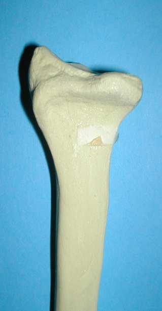 tubercle dorsal view