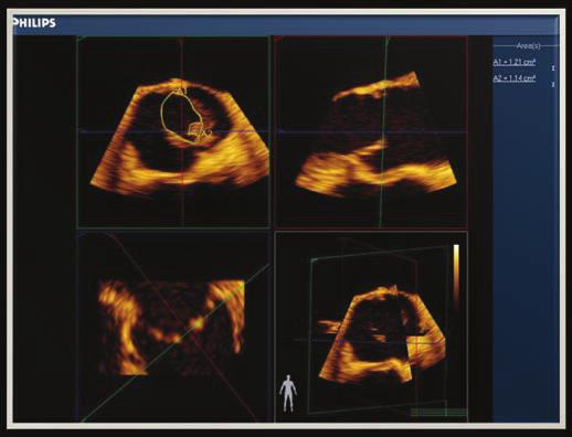 2 Case Reports in Anesthesiology Table 1: Hemodynamic changes associated with pregnancy.