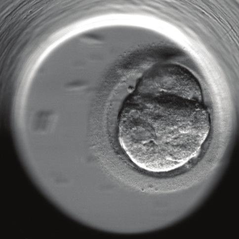 uid) in the IVF laboratory, the sperm