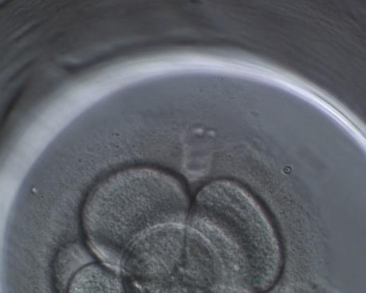 lower risk of potential multiple pregnancies since a smaller number of embryos