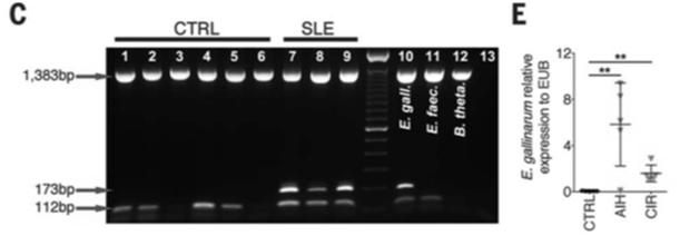 Detection of EG DNA in liver bxs