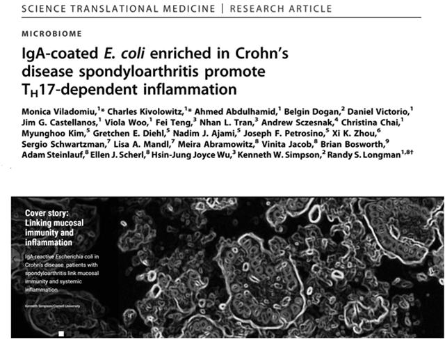 Perturbed mucosal immunity and dysbiosis accompany clinical disease in a rat model of spondyloarthritis Asquith et.al., Arthritis & Rheumatology,2016, 68:2151 Feb 8, 2017 Unresolved questions: Increased bowel permeability is not unique to AS.