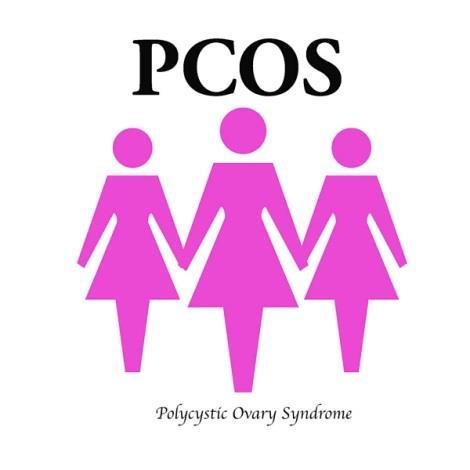 Androgens and PCOS Androgen excess is a key