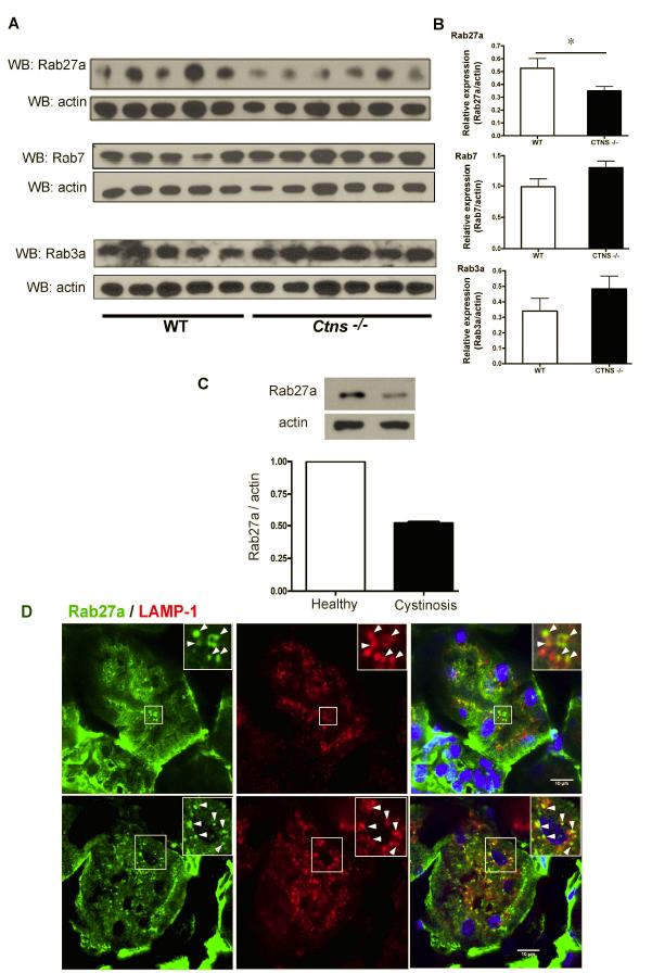 Figure 4. Rab27a localizes at lysosomes and is downregulated in cystinotic cells and tissues A, Expression of endogenous Rab GTPases in kidney lysates from wild type or Ctns -/- mice.