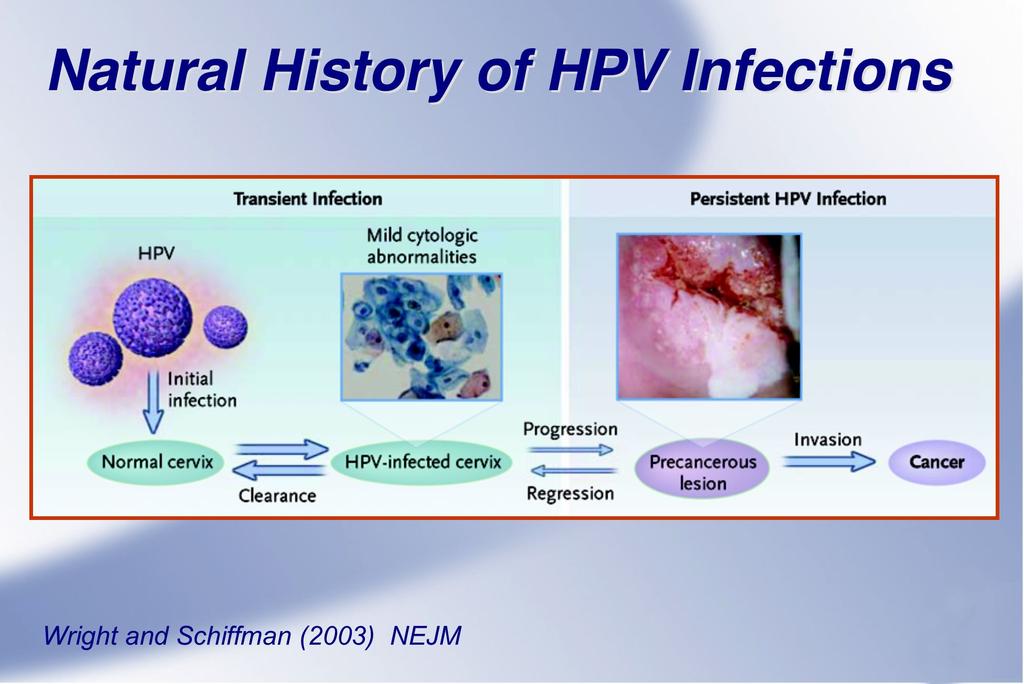 Cervical CA--Diagnosis HPV types & Cancer risk Pap smear for screening Biopsy for abnormal cervix HPV TYPE CANCER RISK 6,11, 42-44 Low to nil 31,33,35,39,51-53,58,59,66,68 Intermediate 16,18, 45, 56