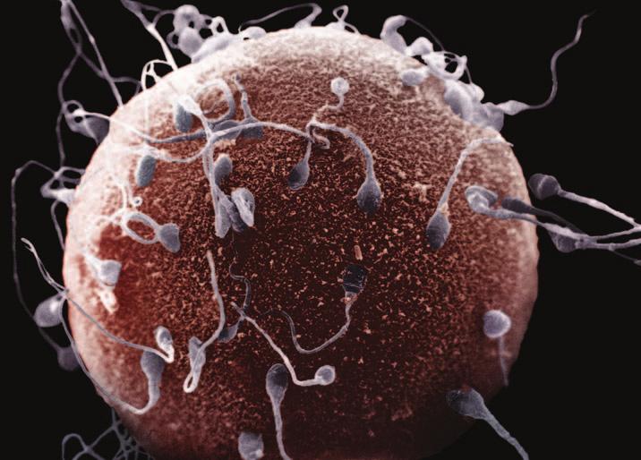 1270 Chapter 21: Sexual Reproduction: Meiosis, Germ Cells, and Fertilization Figure 21 2 Scanning electron micrograph of an egg with many human sperm bound to its surface.