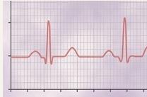 voltaj Electrocardiograma reprezinta inregistrarea grafica a potentialelor electrice generate de fibrele miocardice de lucru Cordul este suspendat intr-un mediu bun
