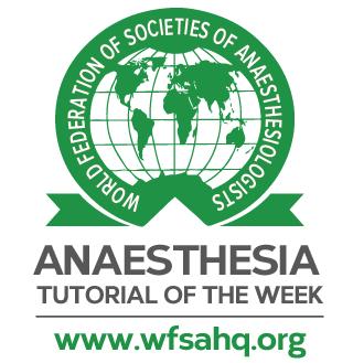 O B S T E T R I C A N A E S T H E S I A Tutorial 350 Neuraxial anesthesia for scoliosis and previous spinal surgery in pregnancy Dr.