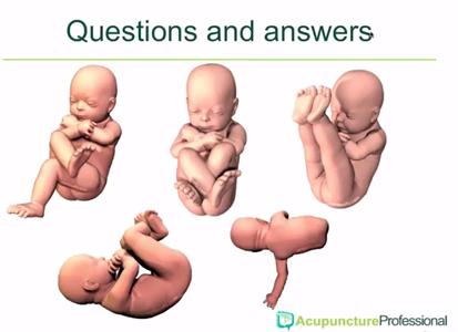 Learning objectives Understanding the issues associated with a baby in breech position Understanding of some of the mother's psychological issues that can prevent a breech baby from turning How and