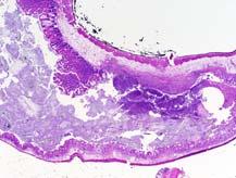 Histologic Scoring of Colitis in Mice Mucosa (M) Mild epithelial hyperplasia 1 Moderate epithelial hyperplasia 2 Severe hyperplasia with crypt branching &/or herniation
