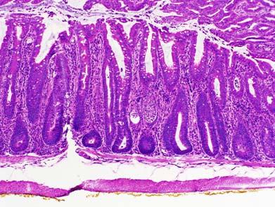 T/I mouse, UC like colitis, terminal colon Mucosa score 2 (moderate hyperplasia); Inflammation score 3 (severe, with crypt abcesses), based on the most severe lesion, even though inflammation is