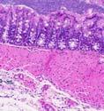 NSAID-Triggered Colitis in Il10 -/- Mice Proximal colon, 6 wks As originally described by Berg et