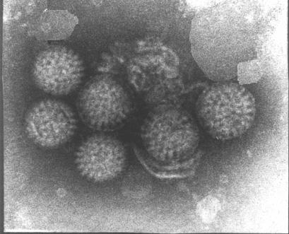 Alternative Rotavirus Vaccine Candidates: Why should we bother?