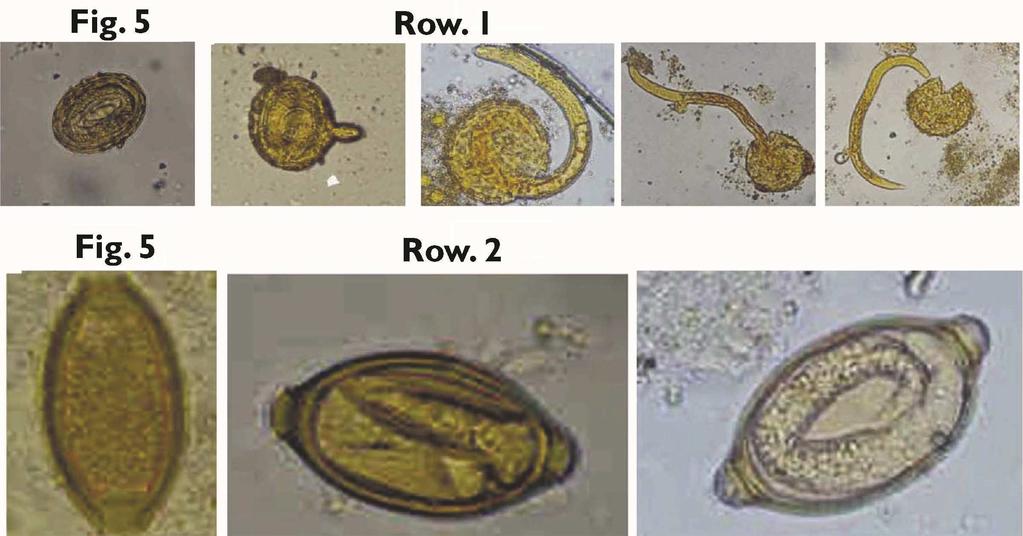 deviation was found in A. lumbricoides, followed by T. trichiura in both study and control groups. CULTIVATION OF A. LUMBRICOIDES AND T.