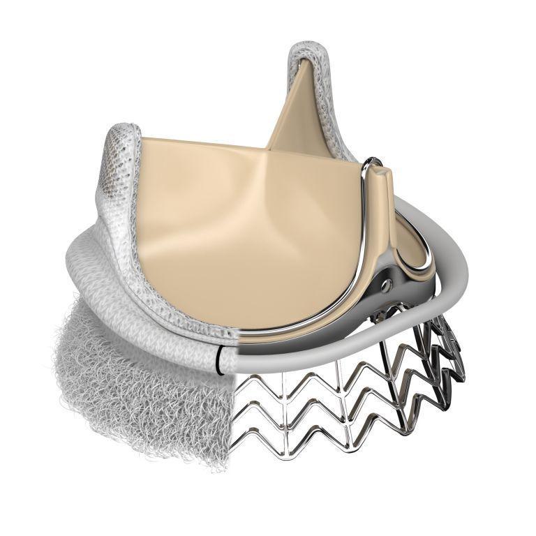 New Innovations Proven Pericardial Technology EDWARDS INTUITY Elite Valve System EDWARDS