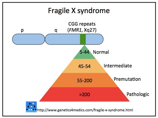 FRAGILE X SYNDROME - Most common
