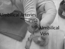 noninvasive Arterial, venous, or capillary Umbilical cord or from the neonate Pre or post ductal