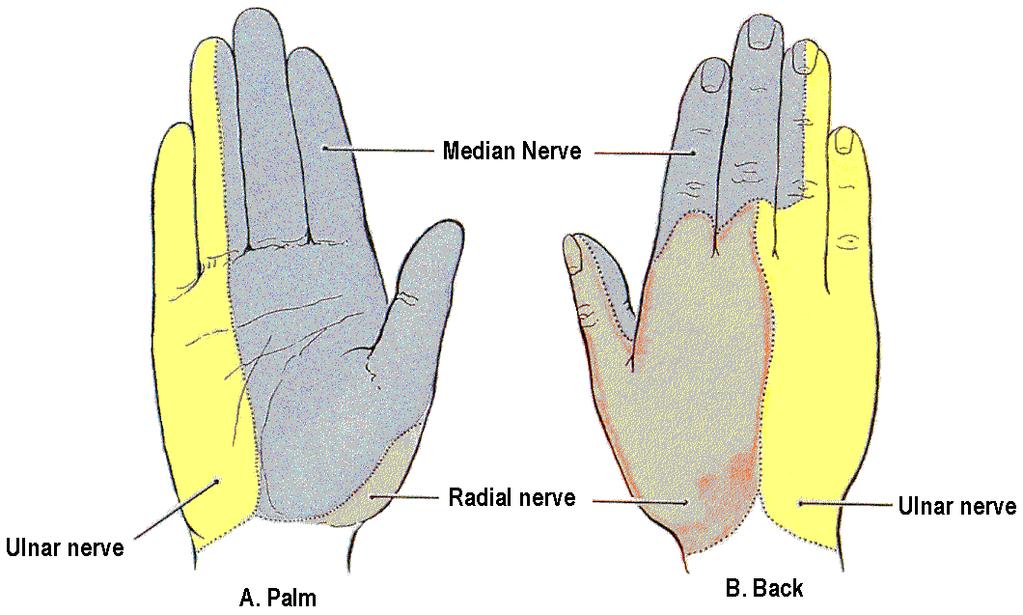 Carpal Tunnel Syndrome How Carpal Tunnel Syndrome Develops Swelling or thickening of the carpal