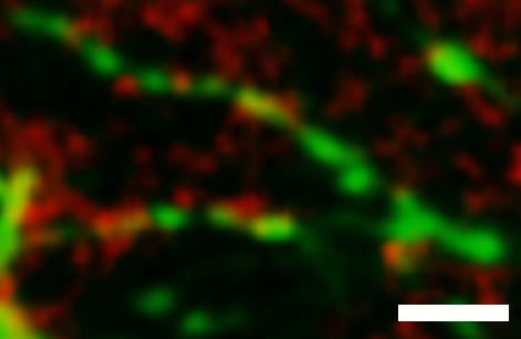 binocular visual cortex (in green) after immunohistochemical staining of excitatory pre-synaptic terminals by VGlut1 (in red).