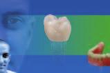 Press Impulse all ceramic all you need Competence in All-Ceramics Competence in Implant Esthetics This