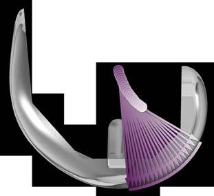 5-10 10 20 30 40 50 60 70 80 90 100 Multi-Radius Design ATTUNE GRADIUS Curve System Reducing Radius Design Knee Flexion