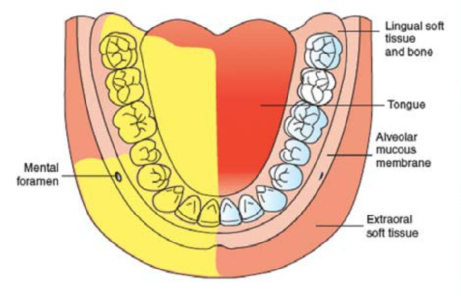 Figure 1. Distribution of anesthesia after inferior alveolar nerve block. Reprinted with permission of Elsevier from Malamed. 3 All rights reserved. through soft tissues.
