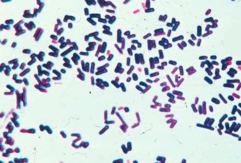 Clostridia that produce invasive infections Many different toxin-producing clostridia can produce invasive infection (including myonecrosis and gas gangrene) if introduced into damaged tissue.