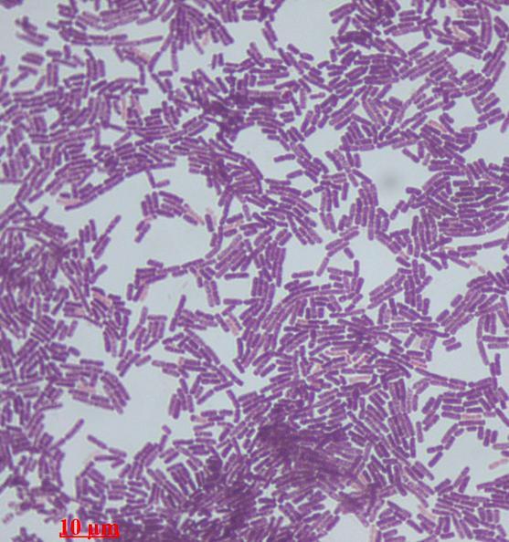 Morphology and identification A 3 4 μ m, arranged in long chains; spores are located in the center of the motile bacilli.