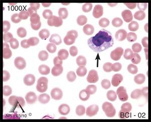 Learning Outcomes Upon completion of this exercise, participants will be able to: discuss morphologic characteristics of normal peripheral blood leukocytes.
