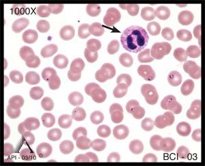 appearance. Sometimes cytoplasmic projections may be seen, as well as a fine dusting of pink or lilac (azurophilic) granules. This monocyte does have numerous azurophilic granules.