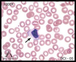 The cytoplasm of segmented neutrophils contains numerous small granules that normally stain violet, tan, or pink. Image BCI-04 shows a band neutrophil.