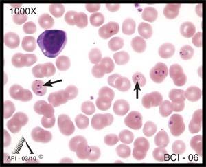 indented by surrounding red blood cells (RBCs). Overall, the cytoplasm may appear gray, pale blue, or deep blue.
