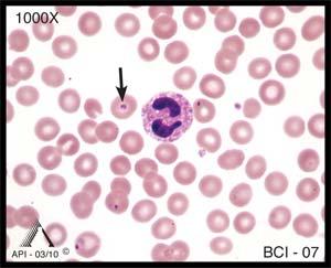 Sometimes reactive lymphocytes resemble monocytes. When identifying any cell, it is important to consider cell size, cytoplasmic characteristics, and nuclear features.