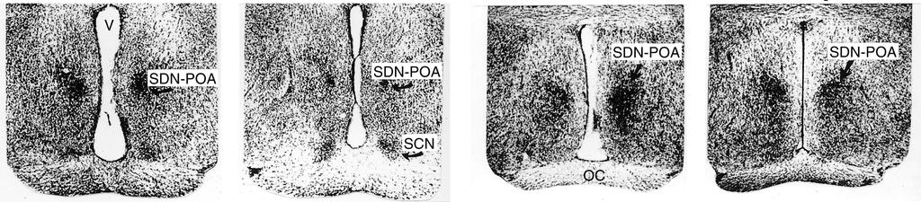 Sexually dimorphic nucleus of the preoptic area (SDN-POA) in the rat hypothalamus The SDN-POA is located on both sides of the third ventricle (V) of the rat brain and is larger in